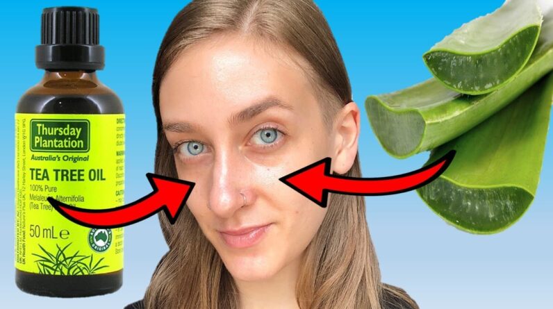 DIY Aloe Vera & Tea Tree oil Moisturizer For Oily, Acne-Prone Skin