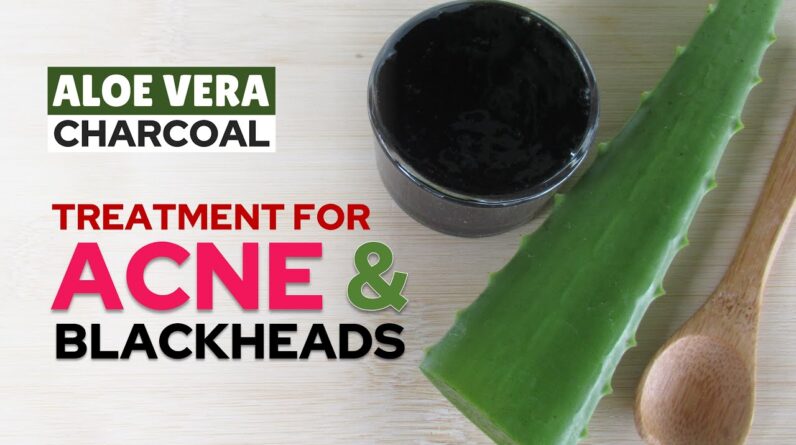 Treatment for Acne and Blackheads - Aloe Vera Mango and Activated Charcoal Face Mask